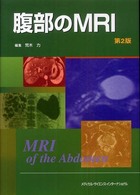 腹部のMRI