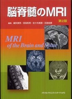 脳脊髄のMRI