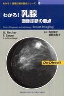 わかる!乳腺画像診断の要点 わかる!画像診断の要点シリーズ