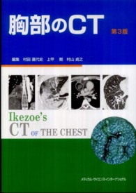 胸部のCT