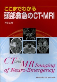 ここまでわかる頭部救急のCT・MRI