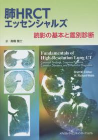 肺HRCTエッセンシャルズ 読影の基本と鑑別診断