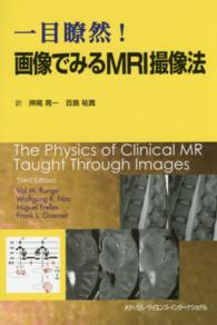 一目瞭然!画像でみるMRI撮像法
