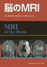脳のMRI