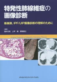 特発性肺線維症の画像診断 蜂巣肺, IPF/UIP画像診断の理解のために  Imaging diagnosis of idiopathic pulmonary fibrosis