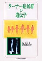 ターナー症候群の遺伝学