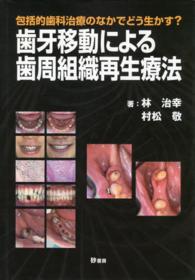 歯牙移動による歯周組織再生療法 包括的歯科治療のなかでどう生かす?
