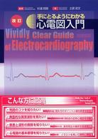 手にとるようにわかる心電図入門