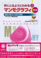 手にとるようにわかるﾏﾝﾓｸﾞﾗﾌｨ 撮影の基本と診断の基礎