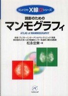 読影のためのマンモグラフィ