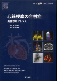 心筋梗塞の合併症 画像診断アトラス