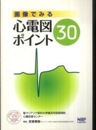 画像でみる心電図ポイント30