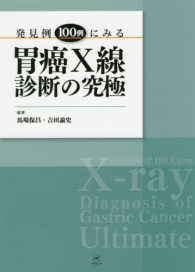 発見例100例にみる胃癌X線診断の究極 Insights of 100 cases x-ray diagnosis of gastric cancer ultimate
