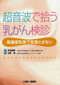 超音波で拾う乳がん検診 高濃度乳房で見落とさない