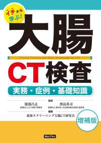 イチから学ぶ!大腸CT検査 実務・症例・基礎知識