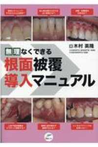 無理なくできる根面被覆導入マニュアル