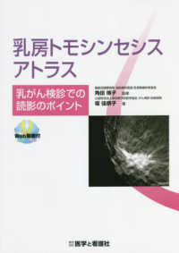 乳房トモシンセシスアトラス : electronic bk 乳がん検診での読影のポイント