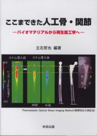 ここまできた人工骨・関節 バイオマテリアルから再生医工学へ